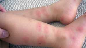 Какво се страхуват хлебарки