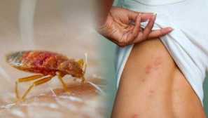 Защо бъговете хапят не всички?