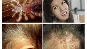 Поръчка на 26 ноември 1998 г. N 342 относно укрепването на мерки за предотвратяване на епидемични смукателни тифове и борбата срещу педикулозните страници. Един