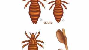 Превантивни мерки за детска педикулоза в детски градини, училища и домашни условия и средства