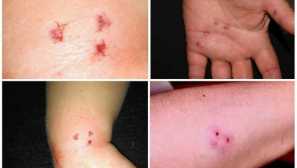 Интерпретация на мечтата интерпретация на сънищата на плъховете